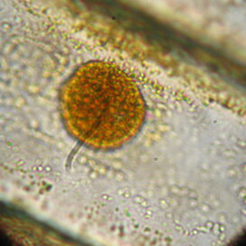 Nucleo cipolla Nucleo cipolla